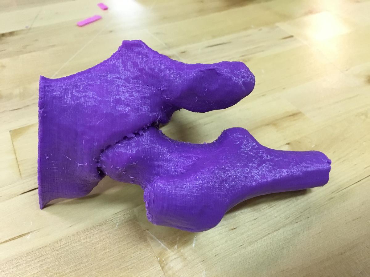 Tomografia Computadorizada do Quadril