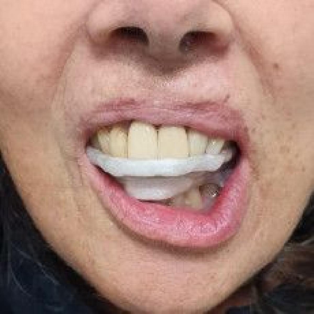 Base PRI UFCSPA   Estrutura de Estente Intraoral Posicional