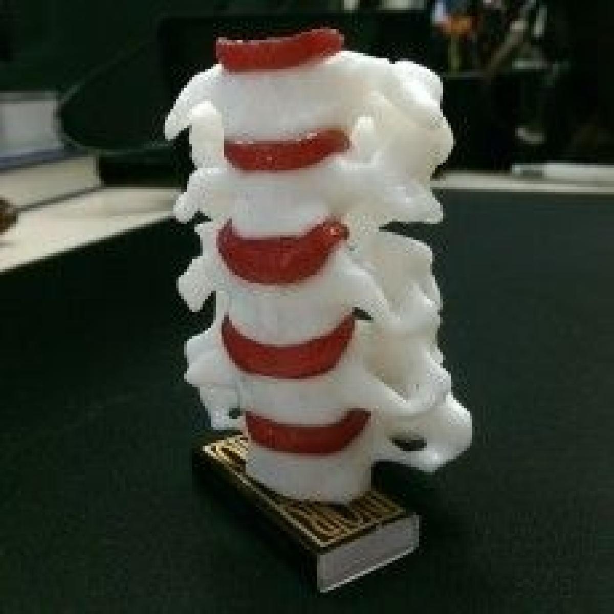 Vértebras cervicais