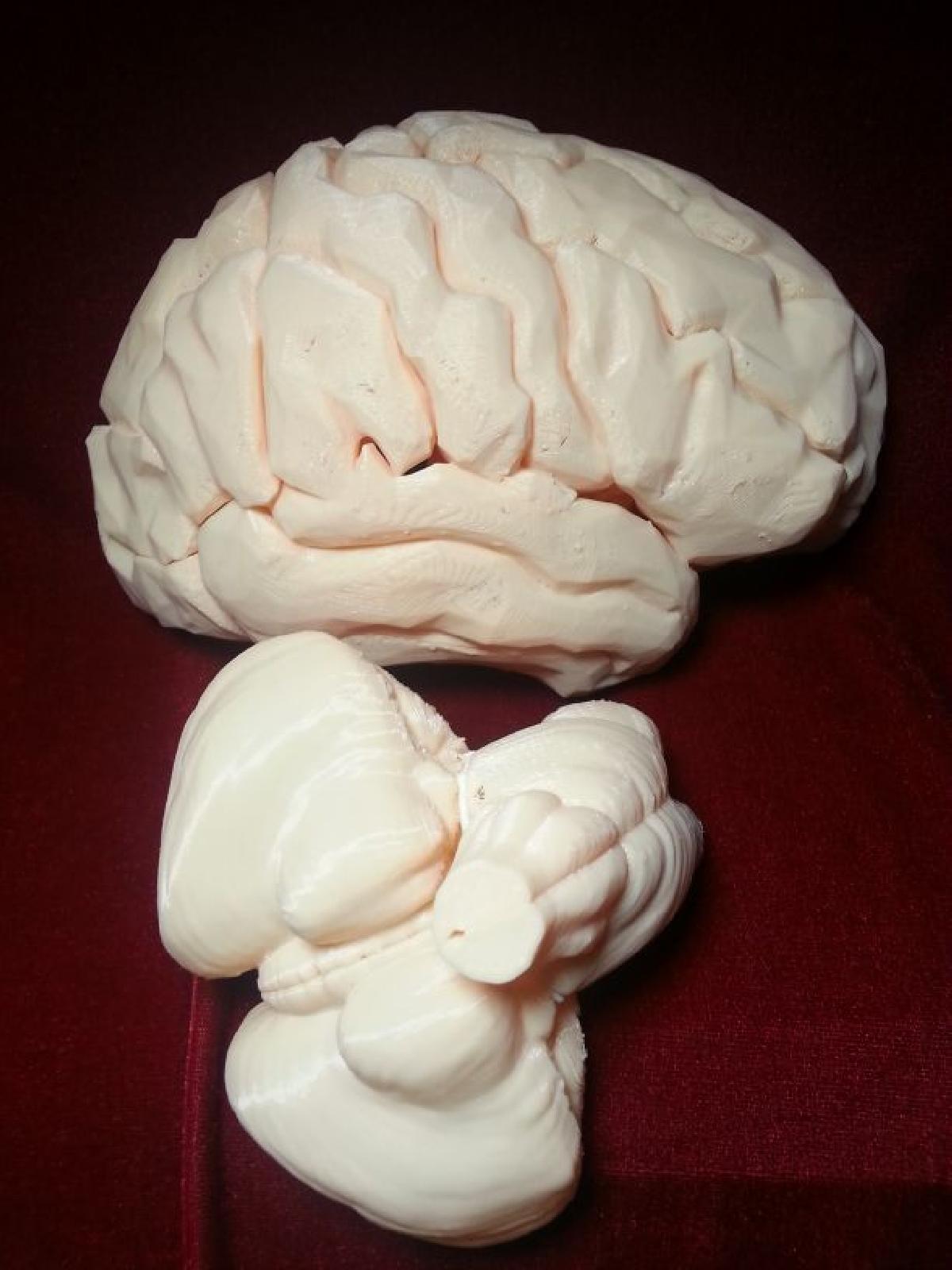 Estudante de Medicina Anatomia 1:1 Tronco encefalico e Cerebelo