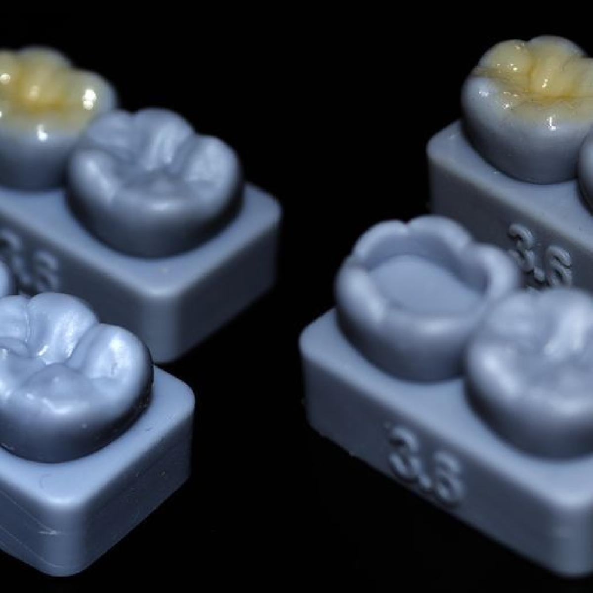 Modelo de restauracao oclusal de dente 3.6