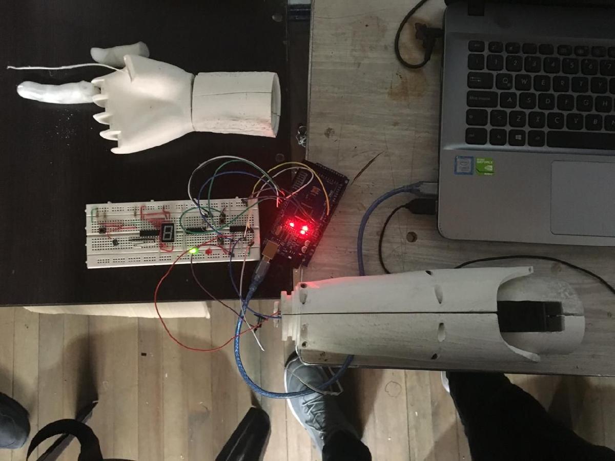 Protese Braco Javier