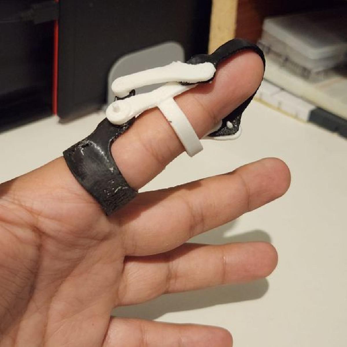 Protesis de falange distal